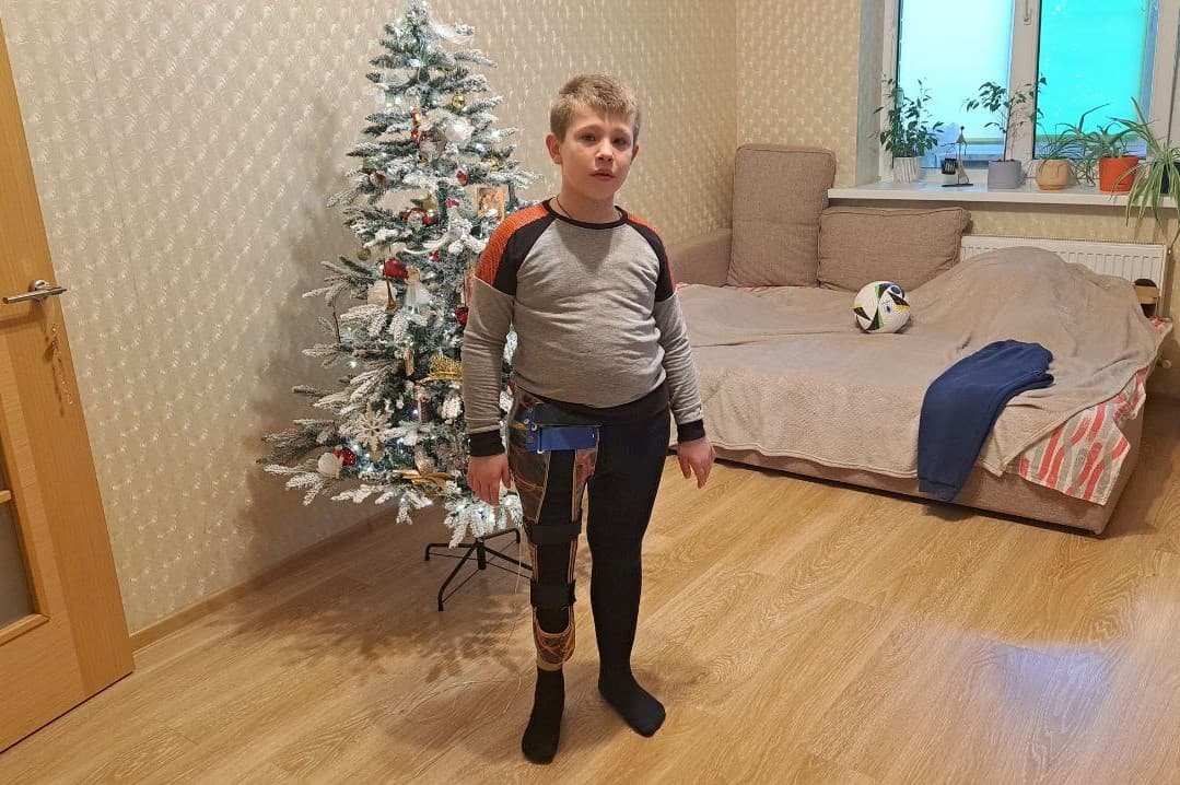Обложка для новости Дамир получил новый протез для активной жизни